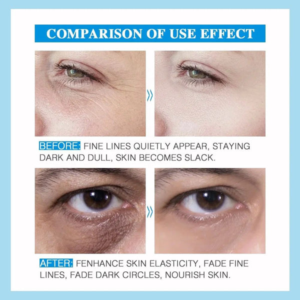Instant Eye Wrinkle Removal, Eye Dark Circles Fading Cream, Anti Aging Rapid Firming, Tightening, Lifting  and Lightening Treatment 20g