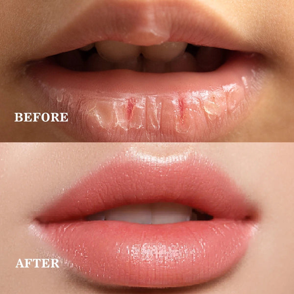 Nourishing, Exfoliating, Moisturizing Fruity Sugar Lip Scrub Stick
