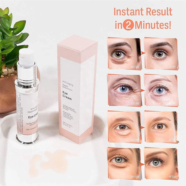 Instant Eye Wrinkle Removal Cream, Anti Aging Rapid Reduction Magic Cream (20g)